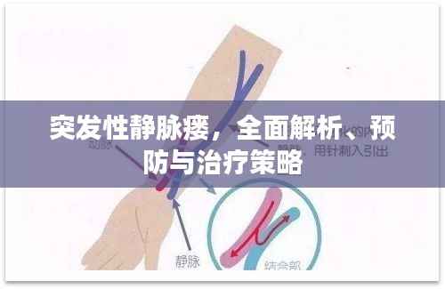 突发性静脉瘘,全面解析、预防与治疗策略